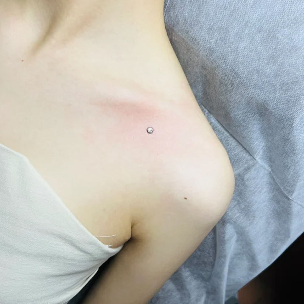 Chirurgenstahl Oberflächenpier – Body Jewelry Dermal Bewertung und Preis